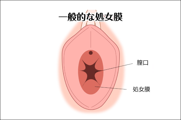 �������̂���I�i�z�[���I���X�g�o�[�W�����y���߂�I�i�z�Ƃ́H