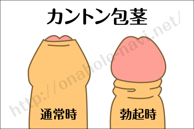 ��s�ł��g����I�i�z�[���I������s�E�^����s�E�J���g����s�Ή���